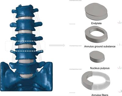 A comparative analysis of using cage acrossing the vertebral ring <mark class="highlighted">apophysis</mark> in normal and osteoporotic models under endplate injury: a finite element analysis